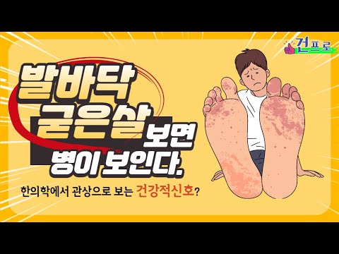 발바닥 굳은살이 보내는 건강 적신호- 발바닥 굳은살이 생긴 부위에 따라 우리 몸에 있는 병을 알 수 있다! 건강하게 100세 시대를 대비합시다.