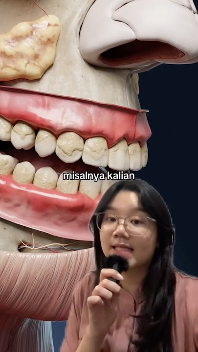 Kenapa KARANG GIGI selalu muncul di dalam mulut?!