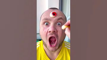 What Ah Oh With Jelly Eyball Funny Comedy Funnyfamily Shorts 
