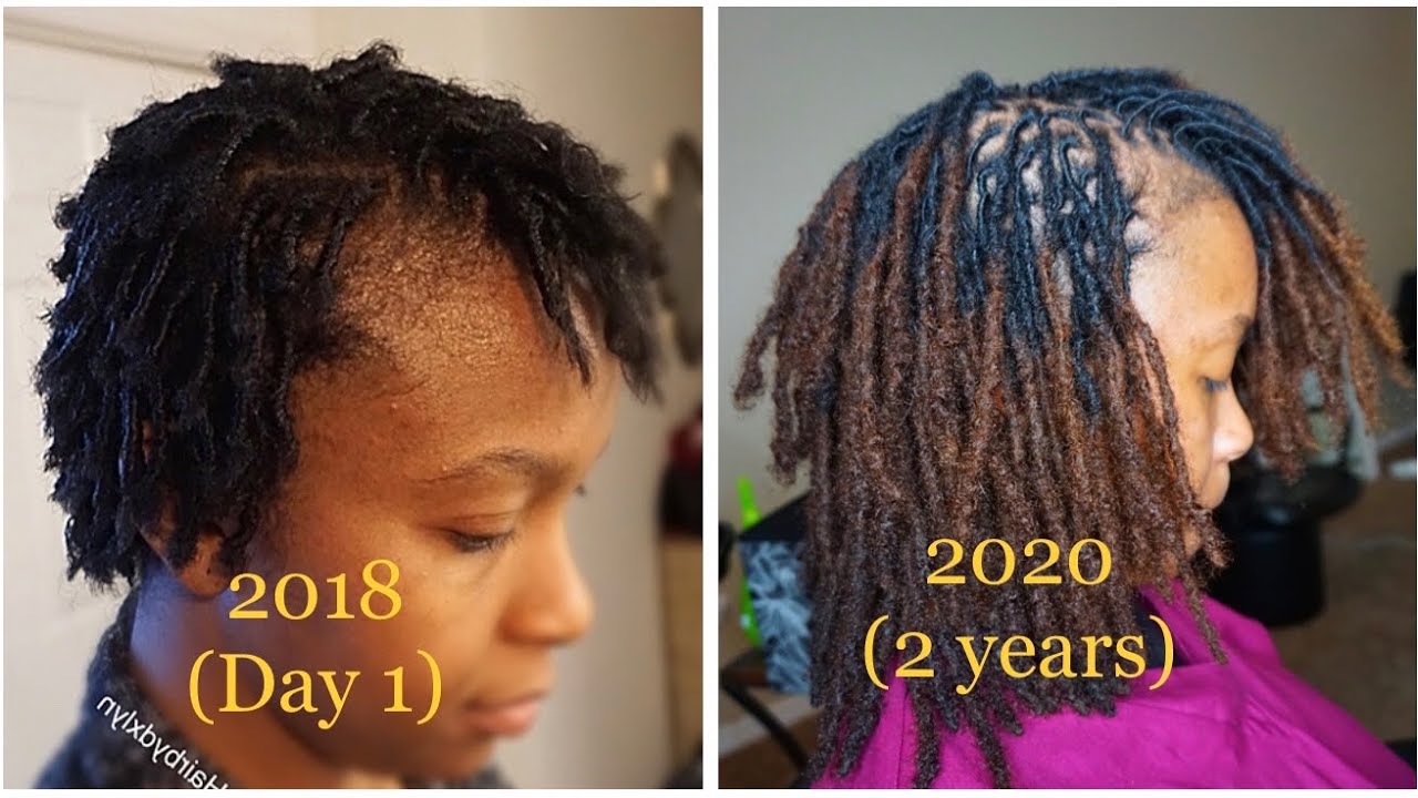 2 year loc journey