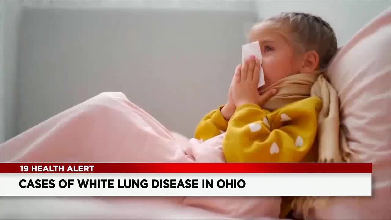 1st cases of White Lung Disease hit Ohio What you need to know YouTube