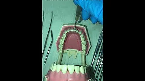 PROFILAXIS DENTAL