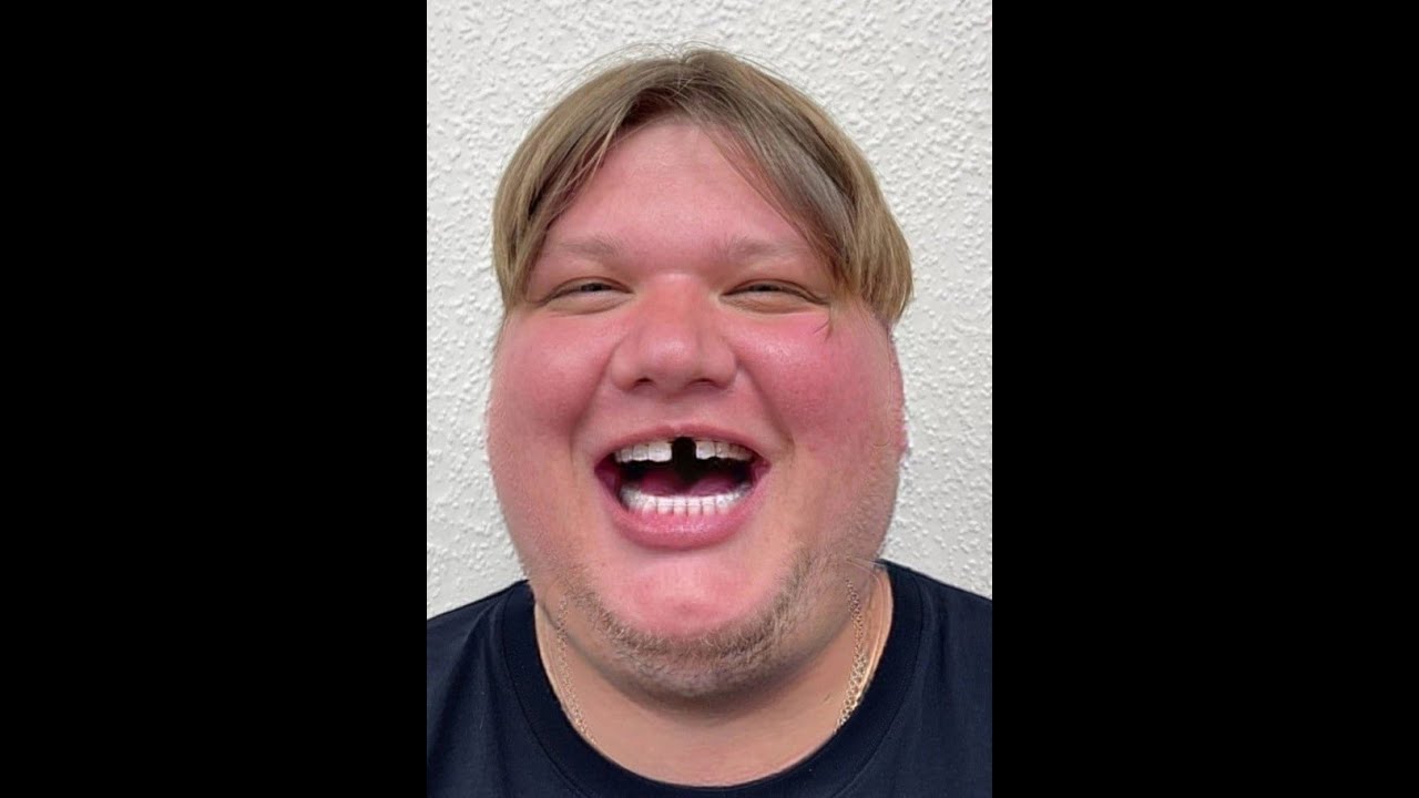 Изи деф от 3000 к часов раст - YouTube