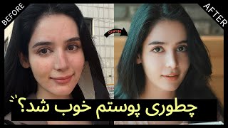 راز پوست خوب کره ایا رو فهمیدم !!!  |  피부 관리