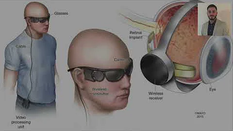 The Bionic Eye - Medical Devices and Diagnostics