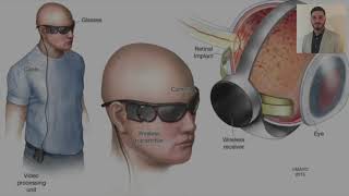 The Bionic Eye - Medical Devices and Diagnostics