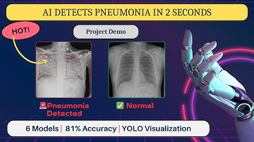 🩺 Pneumonia Detection: A Full Deep Learning Project with 6 AI Models (Python, Streamlit, FastAPI) AI