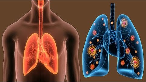 Environment and genetics in lung cancer etiology là gì năm 2024