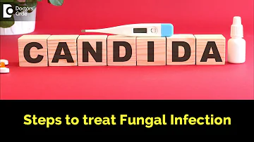 Steps to treat fungal infection (CANDIDA) -  Dr. Rasya Dixit | Doctors' Circle