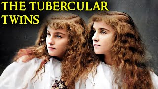 The Tragic Case of the Tubercular Twins