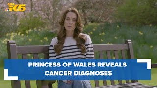 Kate Middleton, the Princess of Wales, undergoing chemotherapy to treat cancer