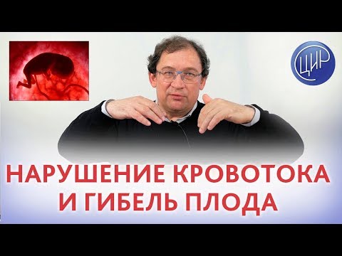 Кровоток плода. НАРУШЕНИЕ КРОВОТОКА и внутриутробная гибель плода. Как НЕ ДОПУСТИТЬ ПОВТОРЕНИЯ ?