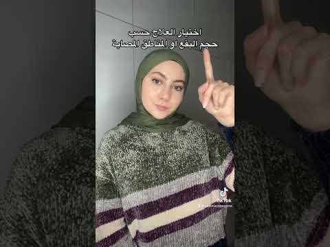 علاج النخالية المبرقشة   