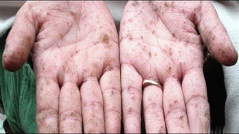 আর্সেনিক এর প্রভাব! Arsenic Poisoning। UGC-NET| FORENSIC SCIENCE |