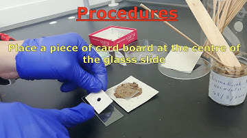 Kato–Katz technique