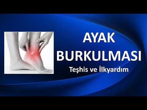 AYAK BURKULMASI TEŞHİS VE İLK YARDIM