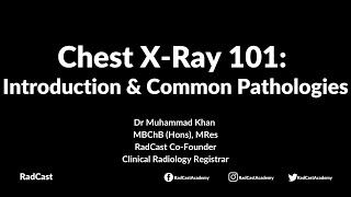 RadCast Academy: Introduction To The Chest XRay & Common Pathologies #cxr #radcast