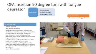 OPA Insertion 90 degree turn