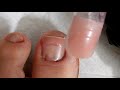 Natural FAKE ACRYLIC Toenails Using Dual Forms  / On Toes Missing Toenails Part 2