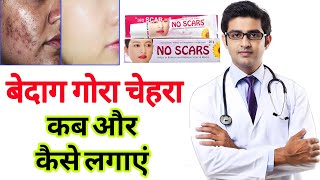 No Scars cream HONEST review 2025 | results, side effects, benefits, uses, price info