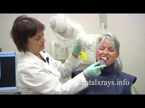 How To Take Dental X-Rays With Bisecting Angle positioning | Dentsply Sirona