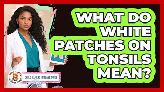 What Do White Patches On Tonsils Mean? What Causes White Spots On Back Of Throat
