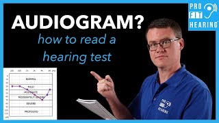 Audiogram? - How to Read a Hearing Test