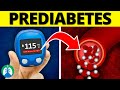 Prediabetes (Medical Definition) | Quick Explainer Video