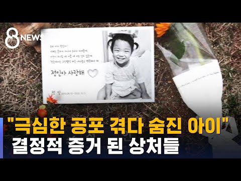 "Pancreatic Transection Proves Intent to Kill... Jung-in Died After Experiencing Extreme Terror" ...
