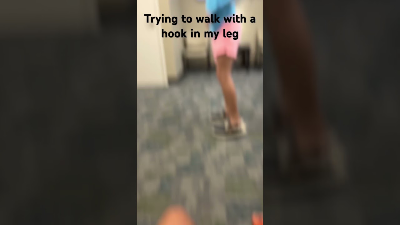 Trying to walk with hook In my leg