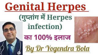 Genital Herpes Infection ke causes , symptoms and 100 % treatment in Hindi |Acyclovir , famciclovir screenshot 1