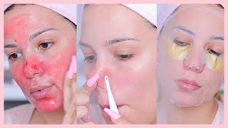 DIY facial at home for CLEAR SKIN *with drugstore products*