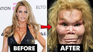 70+ famous celebrity plastic surgery disaster (Before and After) Kelli S Desire For A Smaller Nose Ends In Disaster Botched E