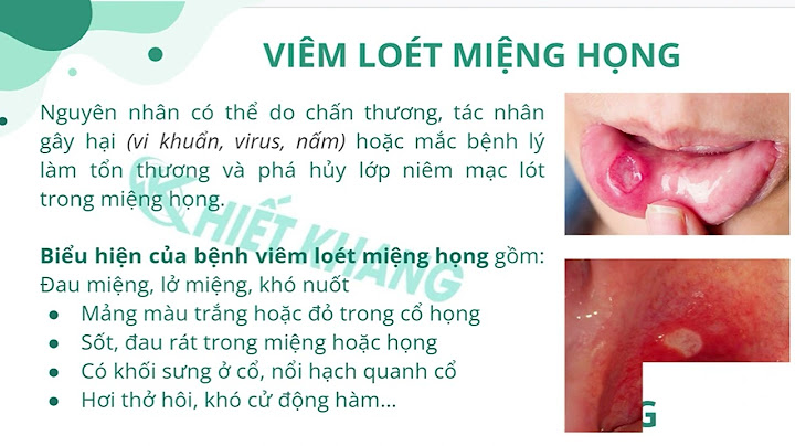 Bệnh áp tơ miệng là gì