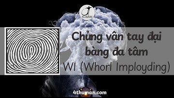 Chủng vân tay đại bàng đa tâm WI (Whorl Imployding)-Thấu hiểu bản thân cùng 4T Human #hieuvebanthan