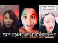 Exploding Head Syndrome Awareness (Sleep Disorder) – TikTok Compilation