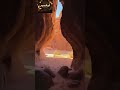 امتي تشكو جراح 