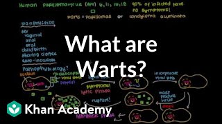 What are warts? | Infectious diseases | NCLEX-RN | Khan Academy