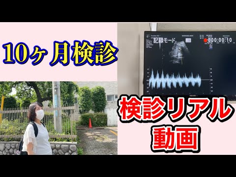 【検診をスマホで撮影】予定日まで16日／いつ産まれてもおかしくない？／妊娠ドキュメンタリー