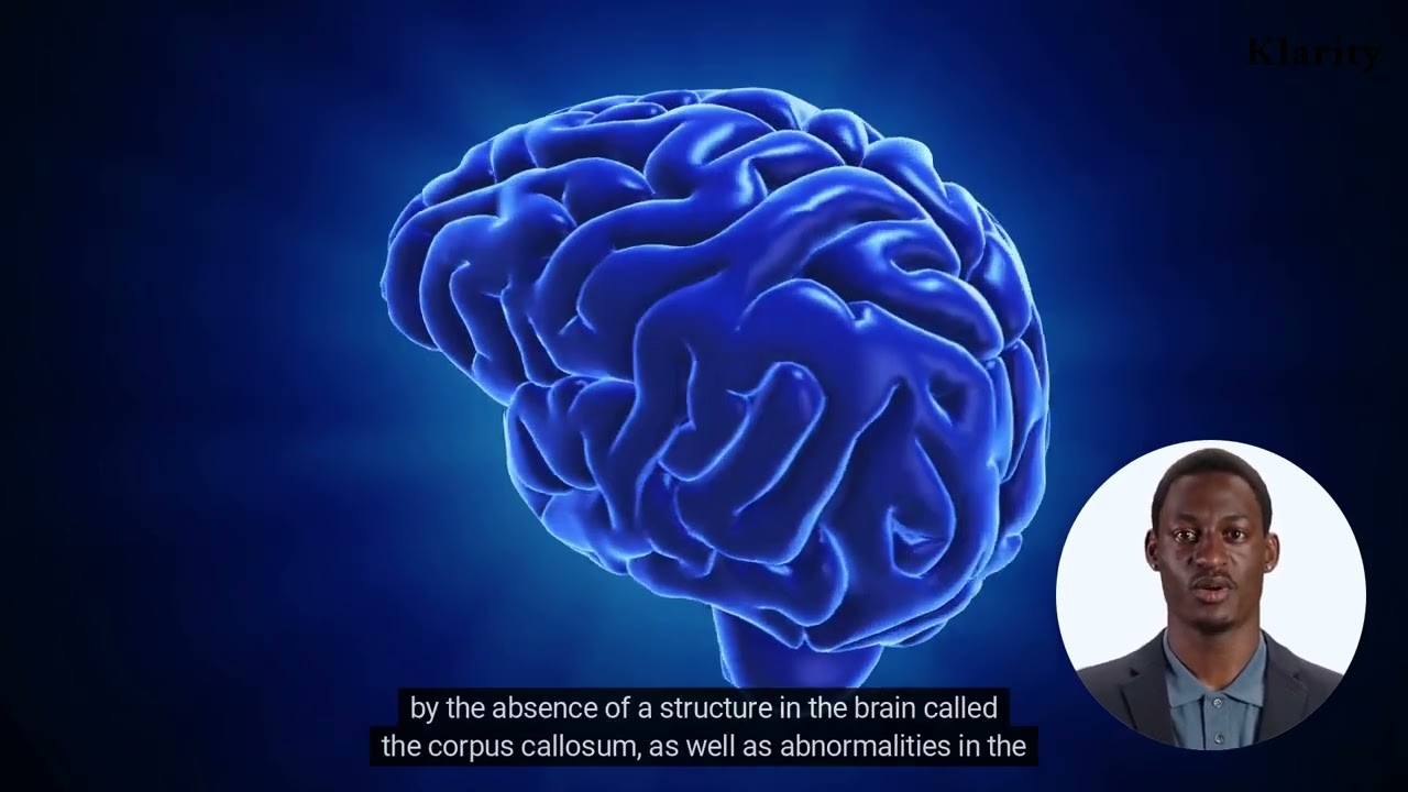 What Is Aicardi Syndrome?