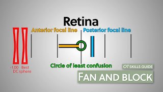 OT skills guide: Fan and block