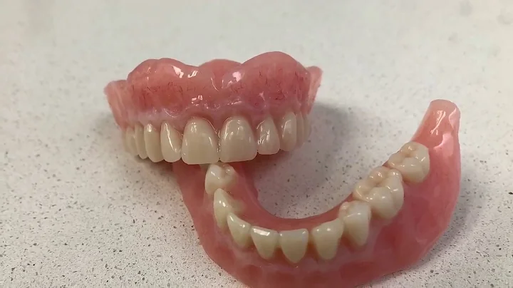 Examples of Suction Dentures at Work