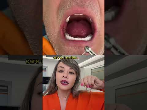 Video: 6 moduri de a face față dispozitivelor dentare