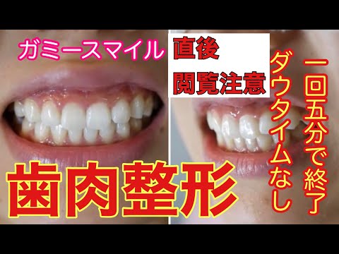 笑った時の歯茎の見えすぎがきになる可愛らしい女性