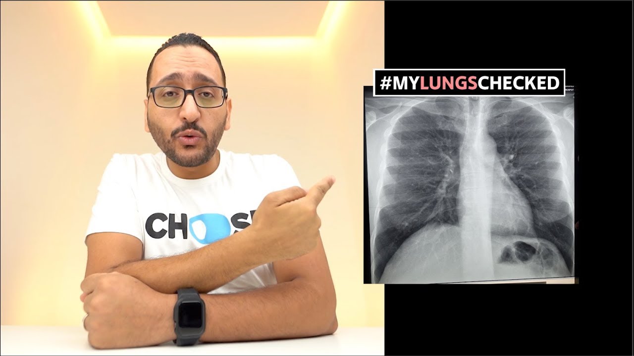 VAPE WAR حرب الفيب