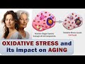 OXIDATIVE STRESS and its impact on AGING - Simply about Difficult