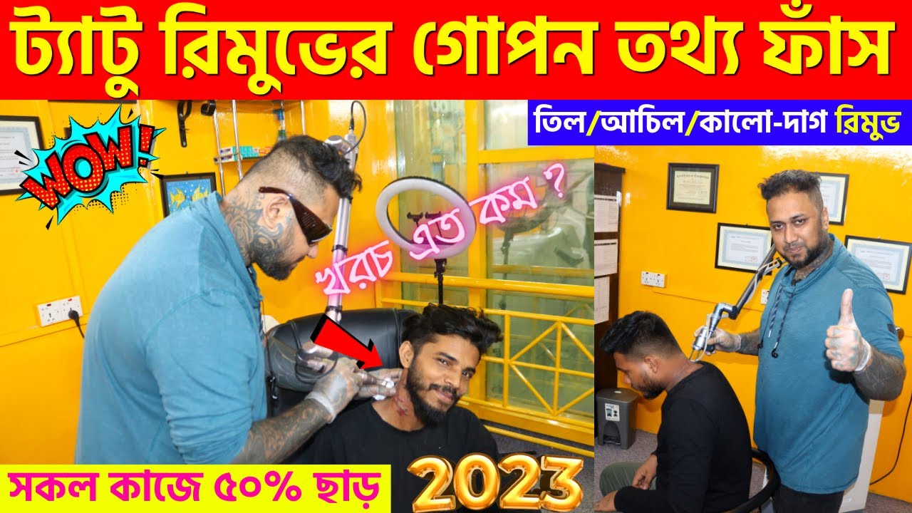 Tattoo Remove Center Dhaka🔥 Tattoo Remove | Laser Tattoo Removal Works | Tattoo  Remove Shop In Dhaka - YouTube