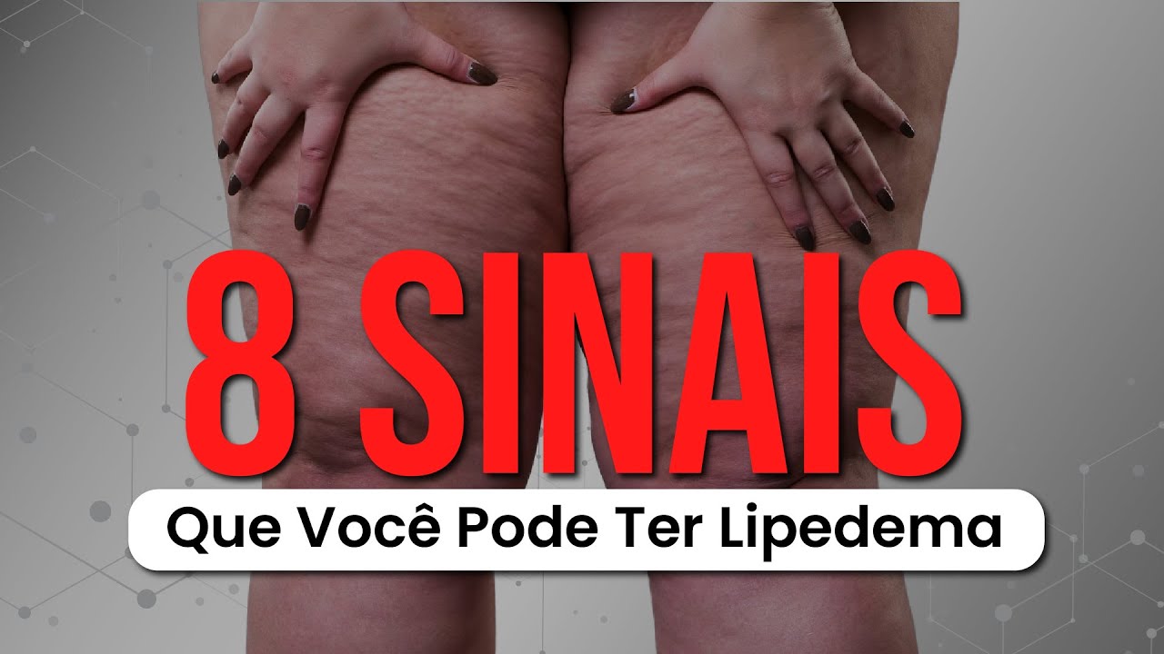 Guia do paciente para o auto-diagnóstico de lipedema e lipo-linfedema