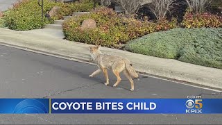 Coyote Attacks, Bites Child Walking With Mother In Moraga Neighborhood