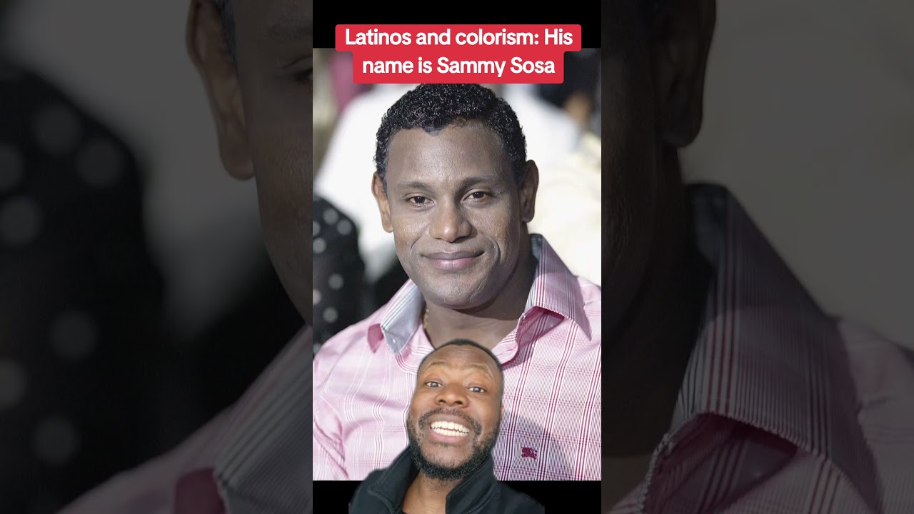 Sammy Sosa’s Skin Color Sparks Debate! 